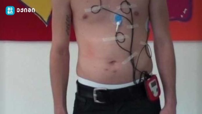 hotleri-1024x576 ჰოლტერის მონიტორინგი