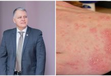 მუნი – რატომ მოიმატა შემთხვევებმა? — გიორგი ფხაკაძე განმარტავს